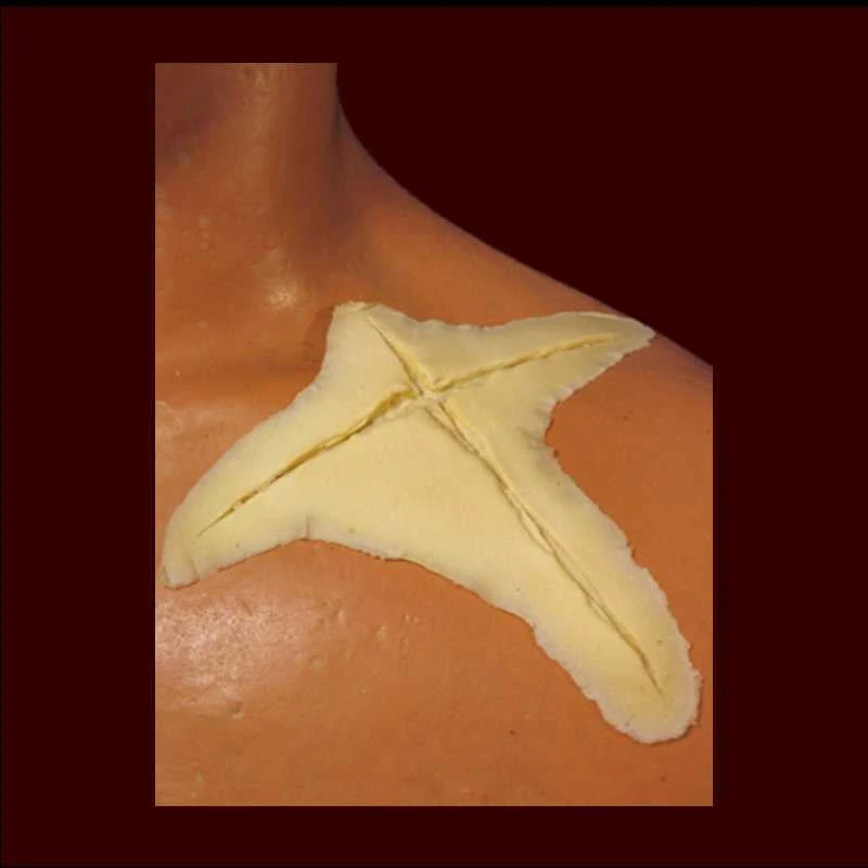 Rubber Wear Injury FX Lg. X Cut 3 Rubber Wear Injury FX Lg. X Cut