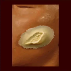 Rubber Wear Injury FX Sm. Skin Gouge