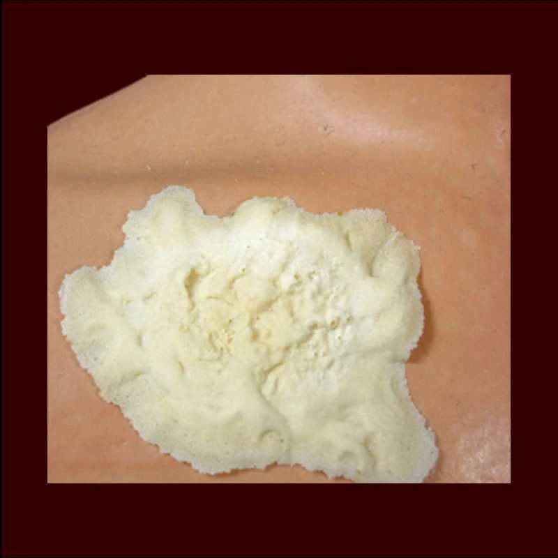 Rubber Wear Burn #1 Injury FX 3 Rubber Wear Burn #1 Injury FX