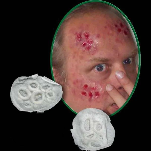 Michael Davy Film & T.V. Makeup Lesions Aired (skin Damage/trauma) 3 Michael Davy Film & T.V. Makeup Lesions Aired (skin Damage/trauma)