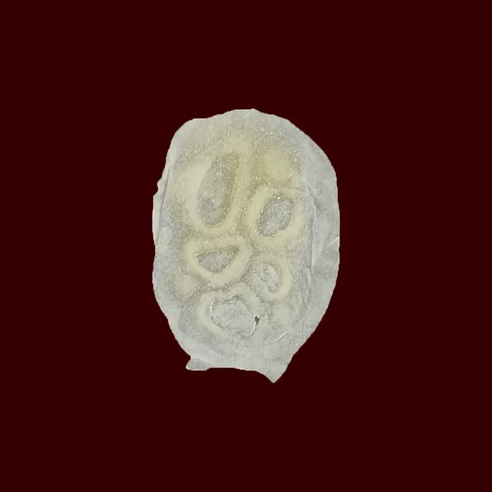 Michael Davy Film & T.V. Makeup Lesions Aired (skin Damage/trauma) 5 Michael Davy Film & T.V. Makeup Lesions Aired (skin Damage/trauma)