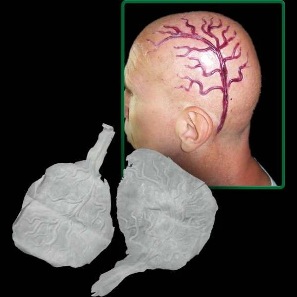 Michael Davy Film & T.V. Makeup You Re So Vein (bulging Veins) Injury FX 3 Michael Davy Film & T.V. Makeup You Re So Vein (bulging Veins) Injury FX