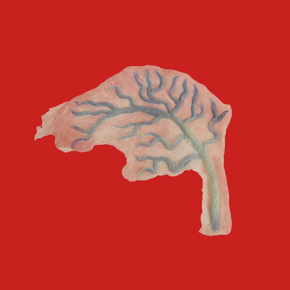 Michael Davy Film & T.V. Makeup You Re So Vein (bulging Veins) Injury FX 5 Michael Davy Film & T.V. Makeup You Re So Vein (bulging Veins) Injury FX